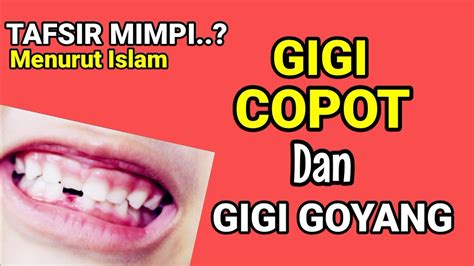 Arti Mimpi Gigi Copot Dan Goyang Menurut Islam Youtube