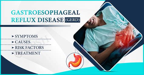 Gastroesophageal Reflux Disease Gerd Symptoms Shekhawati Hospital