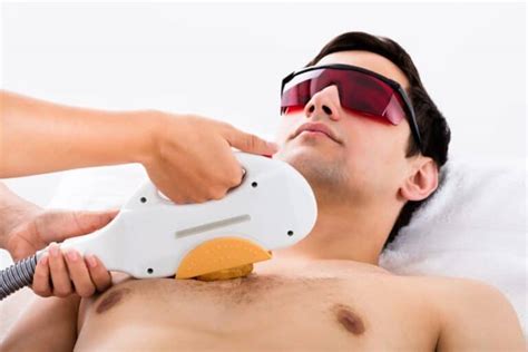 Les avantages de l épilation laser en tant qu homme