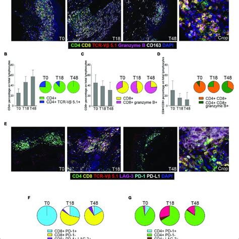 MIHC Analysis Of Skin Infiltrating SS Cells And TILs A