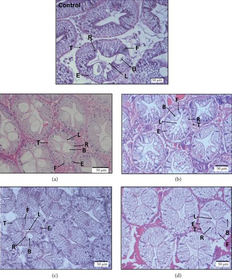 Histological Section Of Hepatopancreas Of The Female Orange Mud Crab