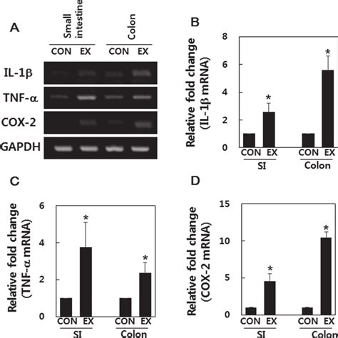 Il 1β Tnf α And Cox 2 Gene Expression In A High Intensity Swimming