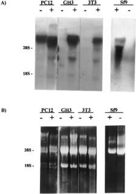 Northern Blot Hybridization Analysis Of Total Rna From Mammalian And