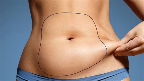 Combien coûte une abdominoplastie avec liposuccion ventre en Tunisie