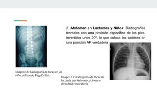 Proteccion Radiologica En Radiologia Portatil Y En Pediatria PPT