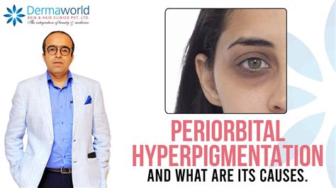 Periorbital Hyperpigmentation and what are its causes | Dr. Rohit Batra ...