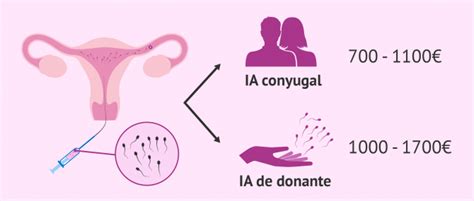 Cu L Es El Precio De La Inseminaci N Artificial Qu Incluye