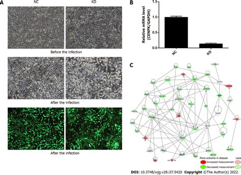 Centromere Protein K Affects The Proliferation And Invasion Of