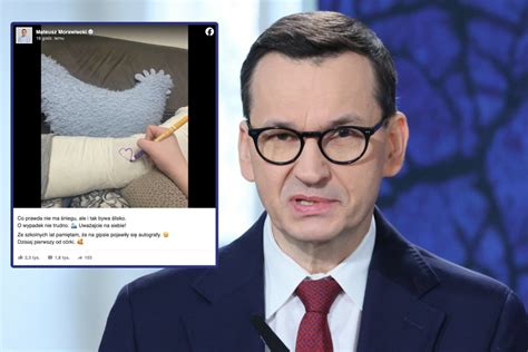 Mateusz Morawiecki złamał nogę Wiadomo w jaki sposób doszło do