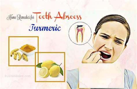 21 Natural And Effective Home Remedies For Tooth Abscess Pain