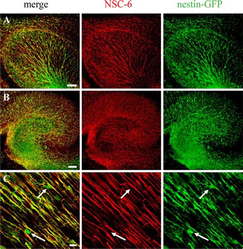 BASP1 Labels Neural Stem Cells In The Neurogenic Niches Of Mammalian