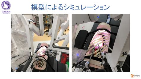 ロボット支援下手術 東北大学加齢医学研究所 呼吸器外科学分野