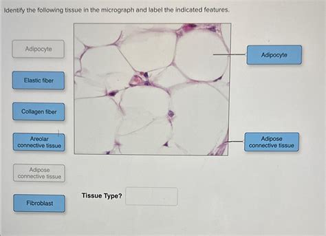 Solved Identify The Following Tissue In The Micrograph And Chegg