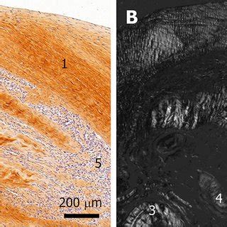 Histological and immunohistochemical analysis of a representative ... 