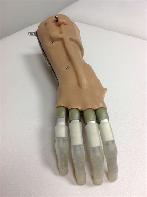 Silicone Prosthesis | Silicone Hand | Partial Hand Prostheses