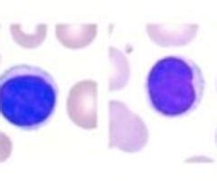 WBC Morphology And Abnormalities Flashcards Quizlet