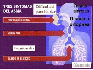 Asma Bronquial En Pediatria Ppt