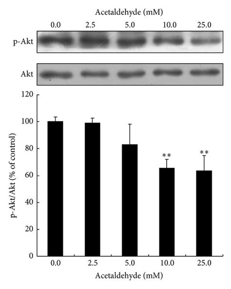 Effects Of Acetaldehyde Treatment On The Activation Of Akt And Creb In