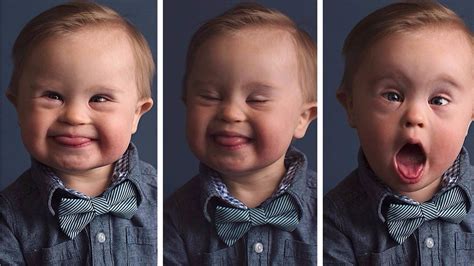 Baby model with Down Syndrome is changing the face of beauty | king5.com