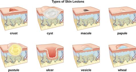 Anatomy And Normal Microbiota Of The Skin And Eyes Microbiology