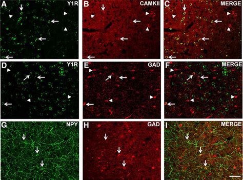 Colocalization Of Y 1 R A F And Npy G I With Camkii Ir Or