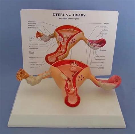 Uterus Yumurtal K Kad N Genital Uterus Modeli Vajinal Yumurtal K