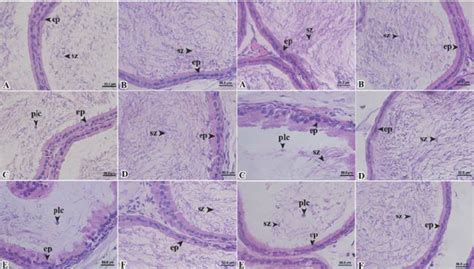 Column 1 Photomicrographs Of Corpus Of Epididymis On Day 42 Column 2