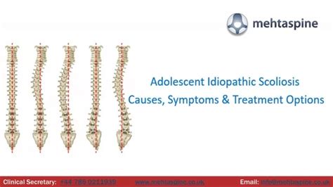 Ppt Adolescent Idiopathic Scoliosis Causes Symptoms And Treatment