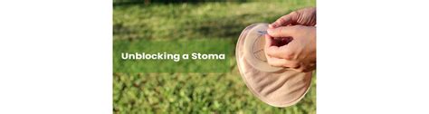 How To Unblock A Stoma 8 Ways To Prevent Bowel Obstruction