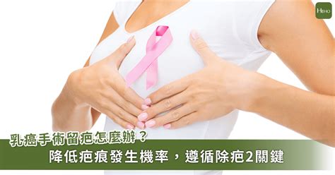 罹患「乳癌」不害怕！專家解析診斷、治療、術後護理 Heho Cancer