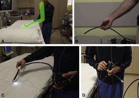 Optimizing Ergonomics During Endoscopy Videogie