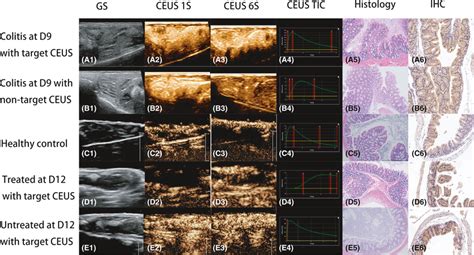 In Vivo Imaging And The Corresponding Pathological Results