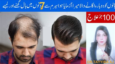 Girty Balo Ko Rokny Wala Serum Diy Powerful Hair Growth Serum