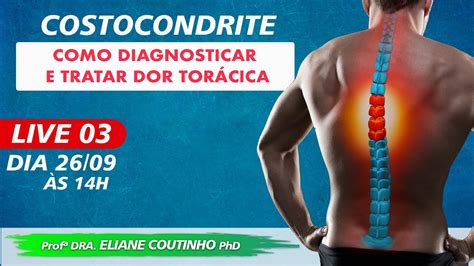 COSTOCONDRITE Como diagnosticar e tratar dor torácica YouTube