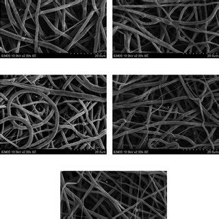 Surface Of Pcl Scaffolds After Contact With Platelet Rich Plasma