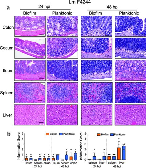 Histopathology Analysis Of Mouse Tissues For Inflammation