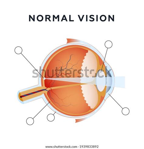 Normal Eye Vision Modern Flat Vector Stock Vector (Royalty Free ...