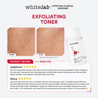 Jual Whitelab Exfoliating Toner Toner Eksfoliasi Pengangkat Sel Kulit