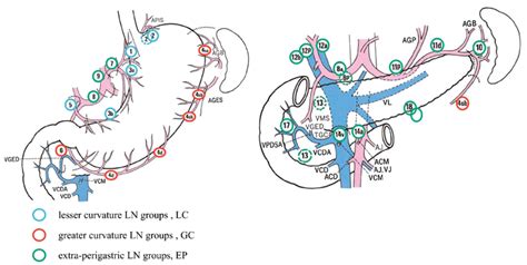 Extra Perigastric Lymph Node Groups EP Lesser Curvature Lymph Node