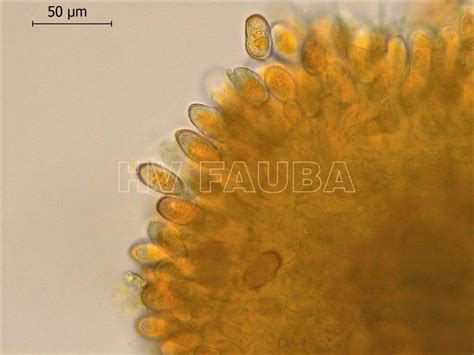 Roya Negra O Del Tallo Del Trigo Puccinia Graminis F Sp Tritici Herbario Virtual Fitopatología