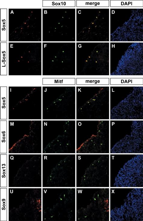 Sox Gene Expression In Melanoblasts Expression Of Sox A C I And