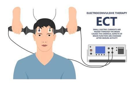 Does Ketamine Have Side Effects?: Pacific KLN Infusions: Ketamine ...