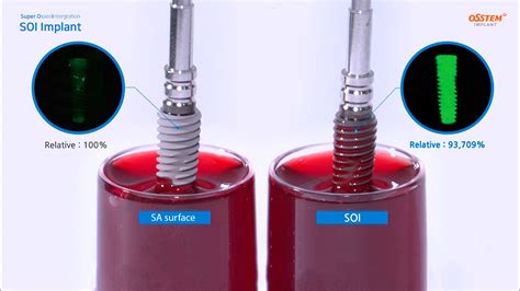 What Is Osstem Implant - Catalog Library