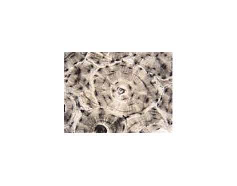 Compact Bone Microscope Slide Quiz