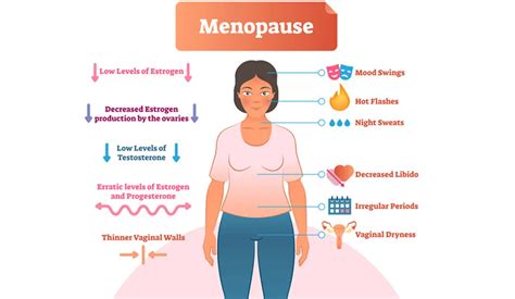 Síntomas de la pre menopausia físicos y psicológicos Colegio de