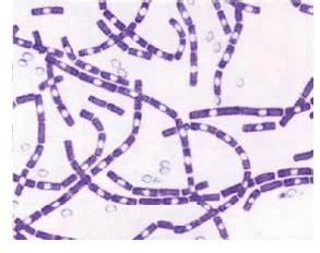 Anthrax Bacillus Cereus And Erysipelothrix Rhusiopathiae