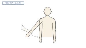腱板断裂について | 新潟の弁護士による交通事故の無料相談 （弁護士法人一新総合法律事務所）