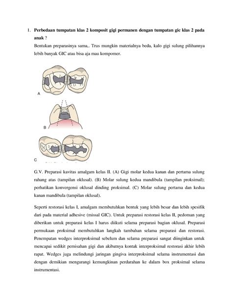 Bahan Ujian Kedokteran Gigi Anak Perbedaan Tumpatan Klas 2 Komposit