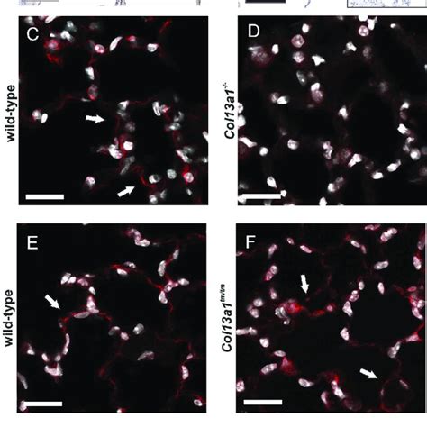 Collagen XIII Expression In Lung Fibrosis A D Collagen XIII