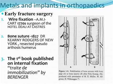 Evolution and generation of orthopaedic implants | PPTX